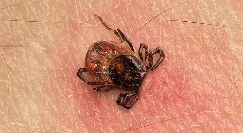 Be aware that it's tick season as you start to head outdoors more: IH